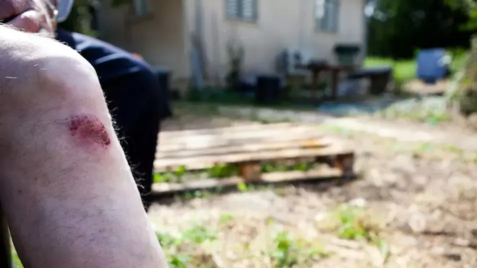חרדי שהוכה ע"י חרדים מקהילת ויז'ניץ , אפריל 2013 חרדי שהוכה ע"י חרדים מקהילת ויז'ניץ , אפריל 2013