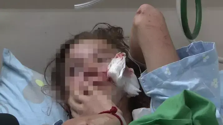 בת 13 ננשכה על ידי כלב בבאר שבע