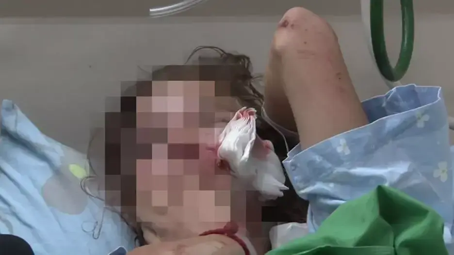 בת 13 ננשכה על ידי כלב בבאר שבע בת 13 ננשכה על ידי כלב בבאר שבע