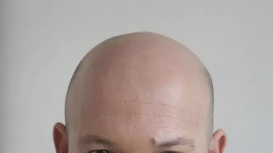 דרור משעני דרור משעני