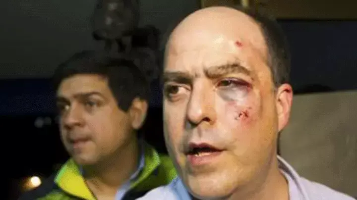 חוליו בורגס, מחוקק מוונצואלה שנפצע בקטטה בפרלמנט, 1 מאי 2013 חוליו בורגס, מחוקק מוונצואלה שנפצע בקטטה בפרלמנט, 1 מאי 2013