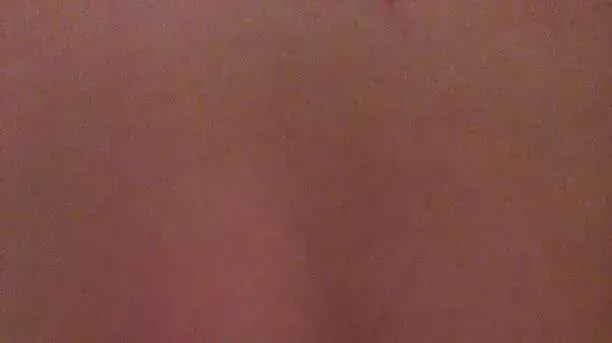 חייל צה"ל שהוכה ע"י שוטר כשהוא אזוק חייל צה"ל שהוכה ע"י שוטר כשהוא אזוק
