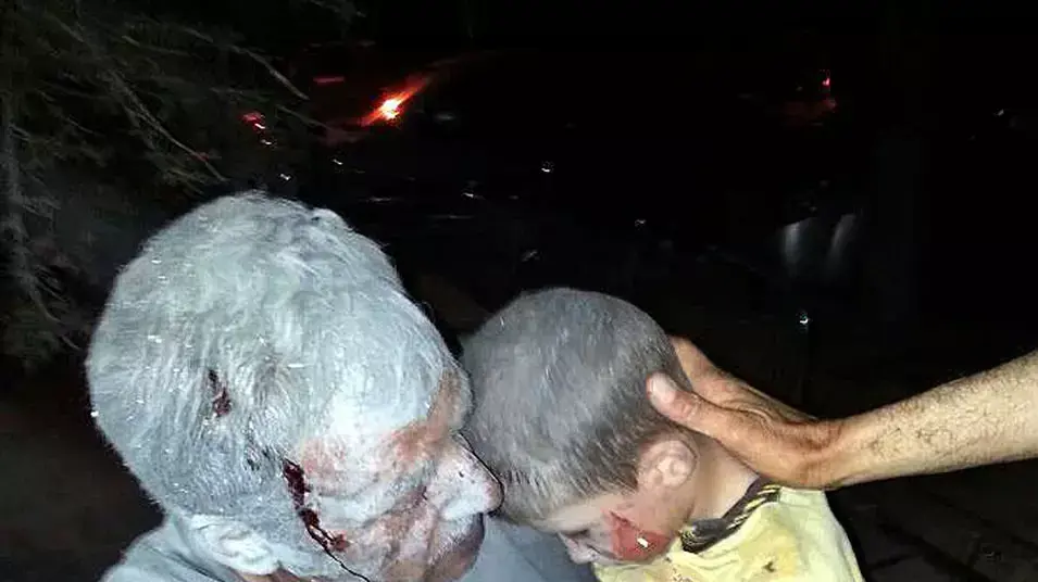 נפגעים בהפצצה אווירית על העיר סראקב בצפון סוריה. אפריל 2013