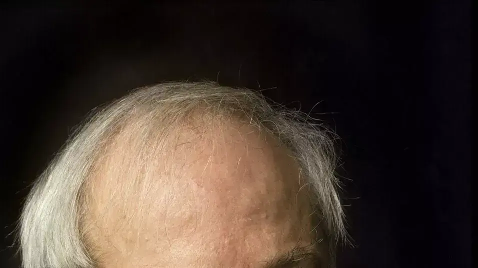 : יורם קניוק : יורם קניוק