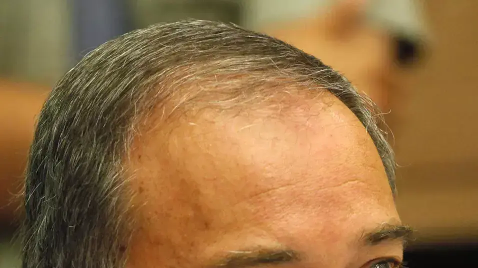 חמישה דברים