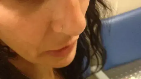 כרמן אלמקייס אחרי תקיפת השוטרים בהפגנה אמש מול ביתו של לפיד, יוני 2013 כרמן אלמקייס אחרי תקיפת השוטרים בהפגנה אמש מול ביתו של לפיד, יוני 2013