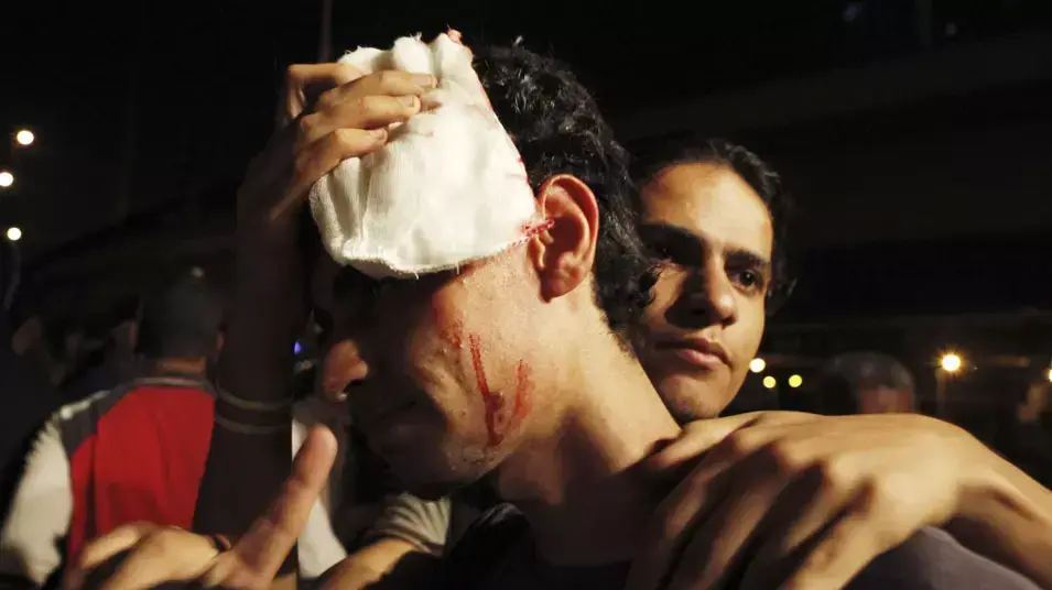 מתנגד מורסי שנפצע בראשו במהלך אחת ההפגנות אתמול בקהיר מתנגד מורסי שנפצע בראשו במהלך אחת ההפגנות אתמול בקהיר