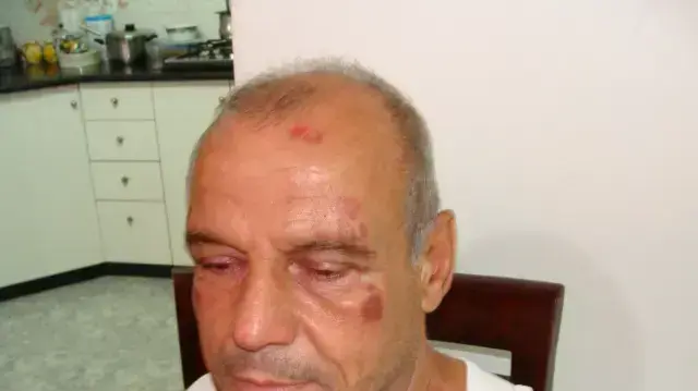 פואד סיקסיק פואד סיקסיק
