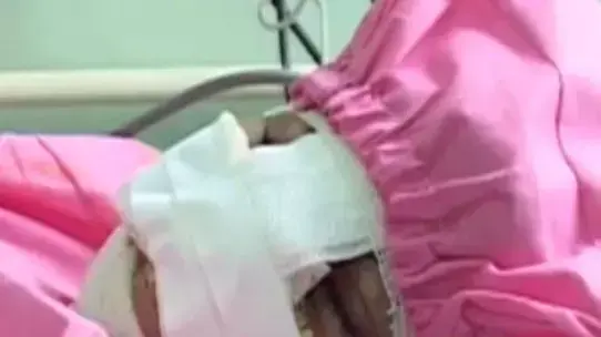 אישה אפגנית שבעלה חתך את אפה ושפתיה כי סירבה לממן את התמכרותו להרואין, דצמבר 2013 אישה אפגנית שבעלה חתך את אפה ושפתיה כי סירבה לממן את התמכרותו להרואין, דצמבר 2013