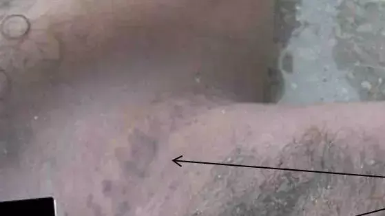 דוח החושף ראיות מהזוועות שמעולל משטר אסד דוח החושף ראיות מהזוועות שמעולל משטר אסד