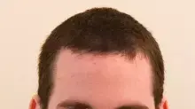 ד"ר אוהד שחר  רופא מתמחה בבית החולים הדסה עין כרם