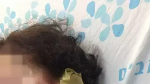 אישה בת 70 ננשכה על ידי פיטבול בקריית ביאליק אישה בת 70 ננשכה על ידי פיטבול בקריית ביאליק