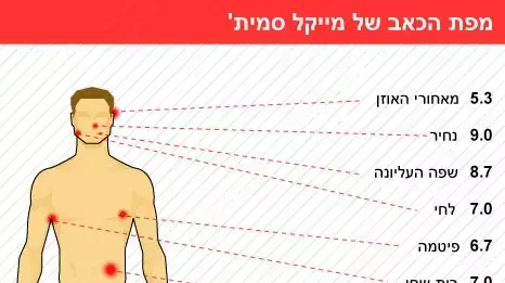מפת הכאב של מייקל סמית' מפת הכאב של מייקל סמית'