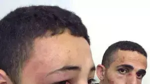 בן דודו של מוחמד אבו חדיר לאחר שהוכה על ידי שוטרי מג"ב