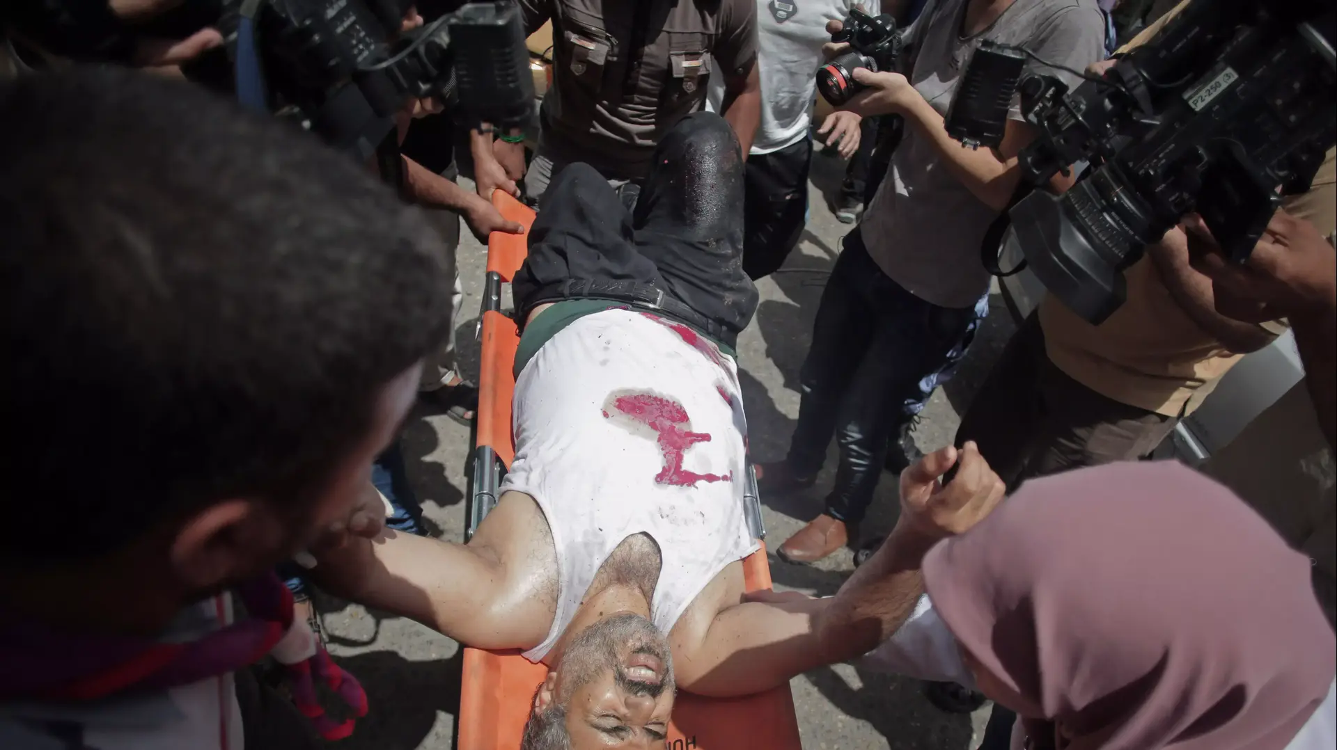 גבר פצוע מפונה לבית החולים בעזה אחרי תקיפת צה"ל, מבצע צוק איתן, יולי 2014 גבר פצוע מפונה לבית החולים בעזה אחרי תקיפת צה"ל, מבצע צוק איתן, יולי 2014