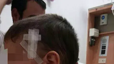 בן שלוש שנפגע מיידוי אבנים בכביש 60 בשומרון בן שלוש שנפגע מיידוי אבנים בכביש 60 בשומרון