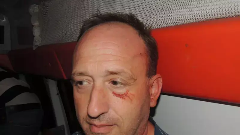 גבר הותקף בטייבה על ידי מקומיים שהוציאו אותו ממכוניתו ושרפו אותה, נובמבר 2014