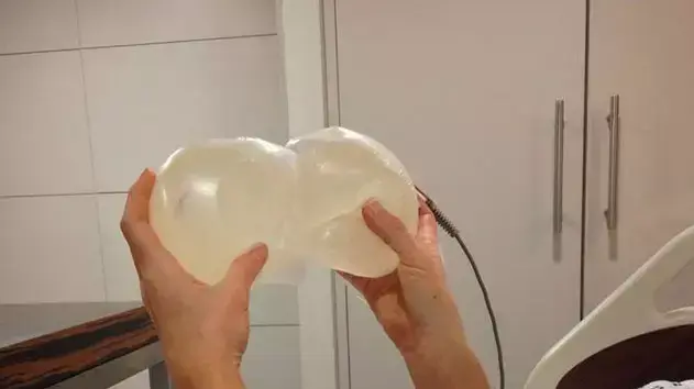 עברה הקטנת חזה כדי להתגייס למשטרה עברה הקטנת חזה כדי להתגייס למשטרה