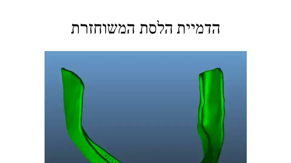 תמונות הדמיה של לפני ואחרי שחזור הלסת של הפצוע הסורי, ינואר 2015. תמונות הדמיה של לפני ואחרי שחזור הלסת של הפצוע הסורי, ינואר 2015.