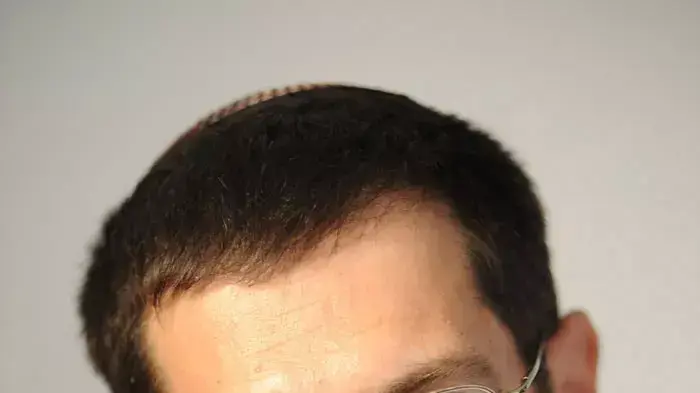 אורי אורבך
