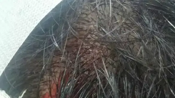 שוטר שהותקף בכפר ג'אסר אזרקא ע"י שני צעירים לאחר שביקש מהתושבים לשמור על השקט, מאי 2015 שוטר שהותקף בכפר ג'אסר אזרקא ע"י שני צעירים לאחר שביקש מהתושבים לשמור על השקט, מאי 2015