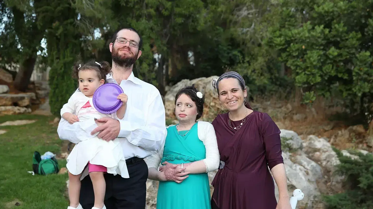 איילה שפירא חוגגת בת מצווה לאחר שנפגעה מבקבוק תבערה, יוני 2015 איילה שפירא חוגגת בת מצווה לאחר שנפגעה מבקבוק תבערה, יוני 2015