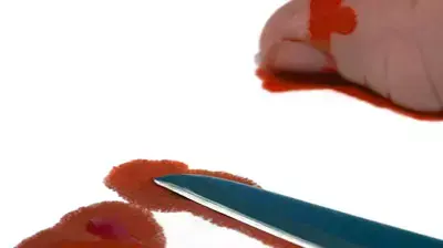 דקירה דם סכין