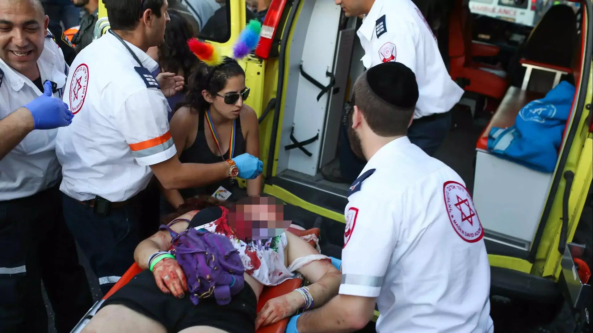 פצועים במצעד הגאווה, ירושלים. יולי 2015 פצועים במצעד הגאווה, ירושלים. יולי 2015