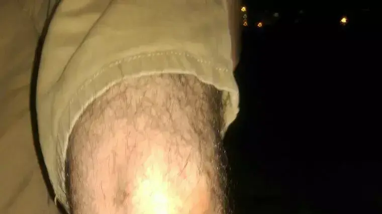 ידויי אבנים לעבר אוטובוס וכלי רכב פרטיים בשכונת א-טור, 18 באוגוסט 2015 ידויי אבנים לעבר אוטובוס וכלי רכב פרטיים בשכונת א-טור, 18 באוגוסט 2015