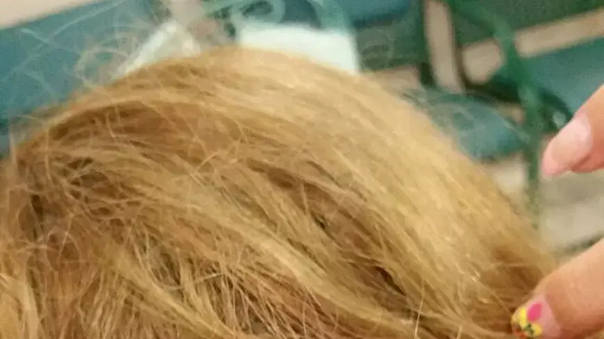 רות ממן נפצעה בראשה מכדור תועה מירדן רות ממן נפצעה בראשה מכדור תועה מירדן