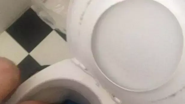 מתקפת נחשים בשירותים באוסטרליה מתקפת נחשים בשירותים באוסטרליה