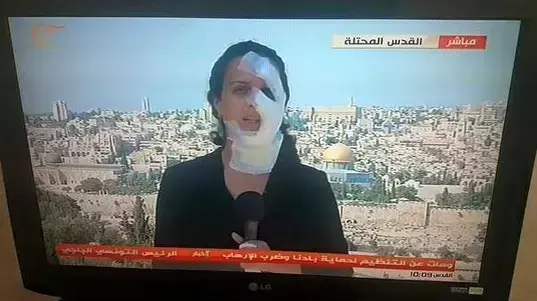רימון הלם התפוצץ ופצע כתבת של רשת "אל-מיאדין" בסמוך לביתו של המחבל מהפיגוע בעיר העתיקה בירושלים, 4 באוקטובר 2015 רימון הלם התפוצץ ופצע כתבת של רשת "אל-מיאדין" בסמוך לביתו של המחבל מהפיגוע בעיר העתיקה בירושלים, 4 באוקטובר 2015