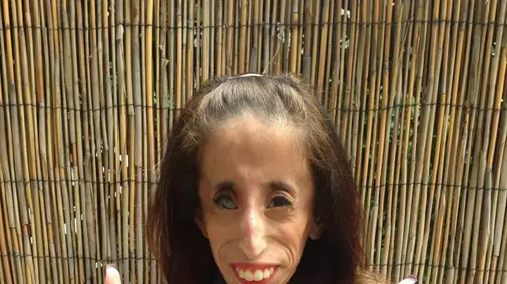 ליזי וואלסקז, האישה המכוערת בעולם ליזי וואלסקז, האישה המכוערת בעולם