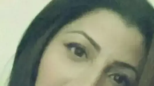 חנן אבולעפיה שמתה במהלך ניתוח אף חנן אבולעפיה שמתה במהלך ניתוח אף