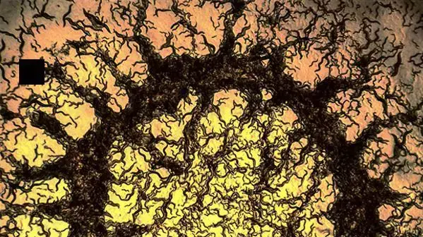 תולעת אוכלת בקטריה- 2015 FASEB BioArt Image תולעת אוכלת בקטריה- 2015 FASEB BioArt Image