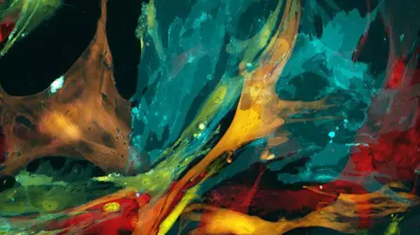 תא סרטן צבוע- 2015 FASEB BioArt Image תא סרטן צבוע- 2015 FASEB BioArt Image