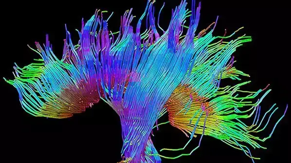 סיב עצב במוח- 2015 FASEB BioArt Image סיב עצב במוח- 2015 FASEB BioArt Image