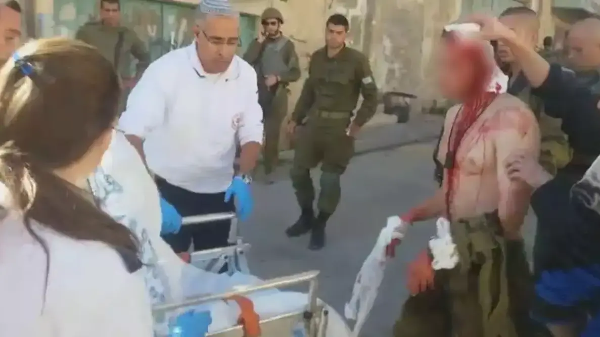 פצוע בפיגוע דקירה בבית הדסה, 9 בדצמבר 2015 פצוע בפיגוע דקירה בבית הדסה, 9 בדצמבר 2015
