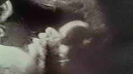 פנים מוזרות בסריקת אולטרסאונד פנים מוזרות בסריקת אולטרסאונד