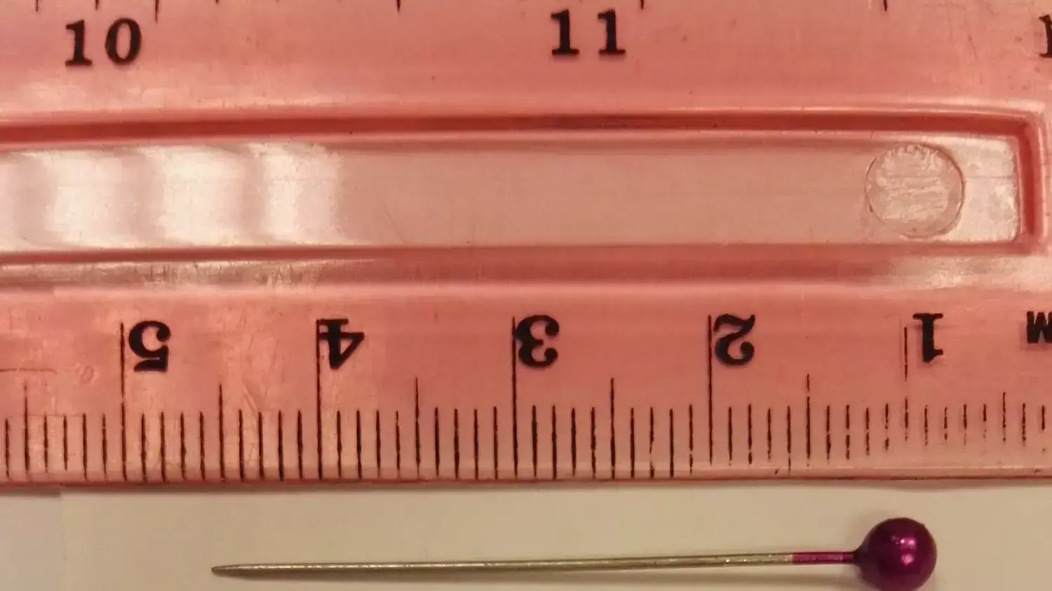 סיכת ראש חולצה מריאה של בת 13 בבית החולים הלל יפה סיכת ראש חולצה מריאה של בת 13 בבית החולים הלל יפה