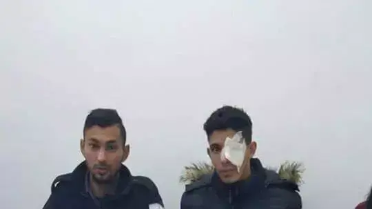עלאא סלאח, תושב מזרח ירושלים שנורה ואיבד את עינו