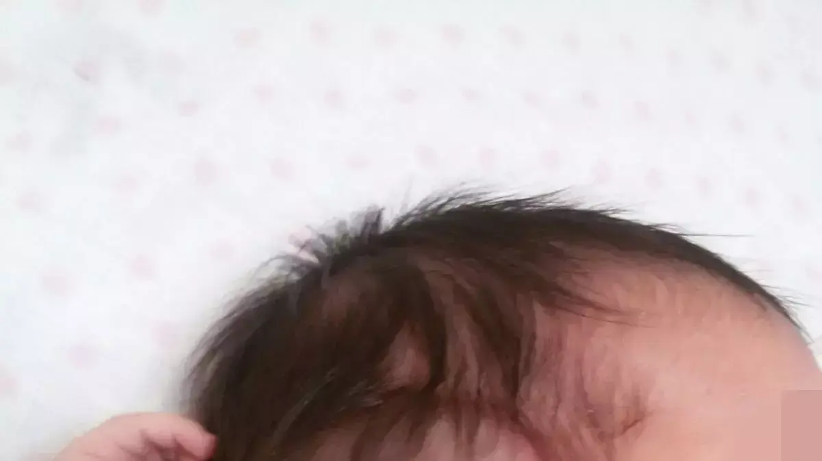 מיכל בויום ובתה, כרמל בויום, הסובלת מתסמונת נדירה. מיכל בויום ובתה, כרמל בויום, הסובלת מתסמונת נדירה.