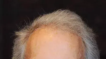 קלינט איסטווד