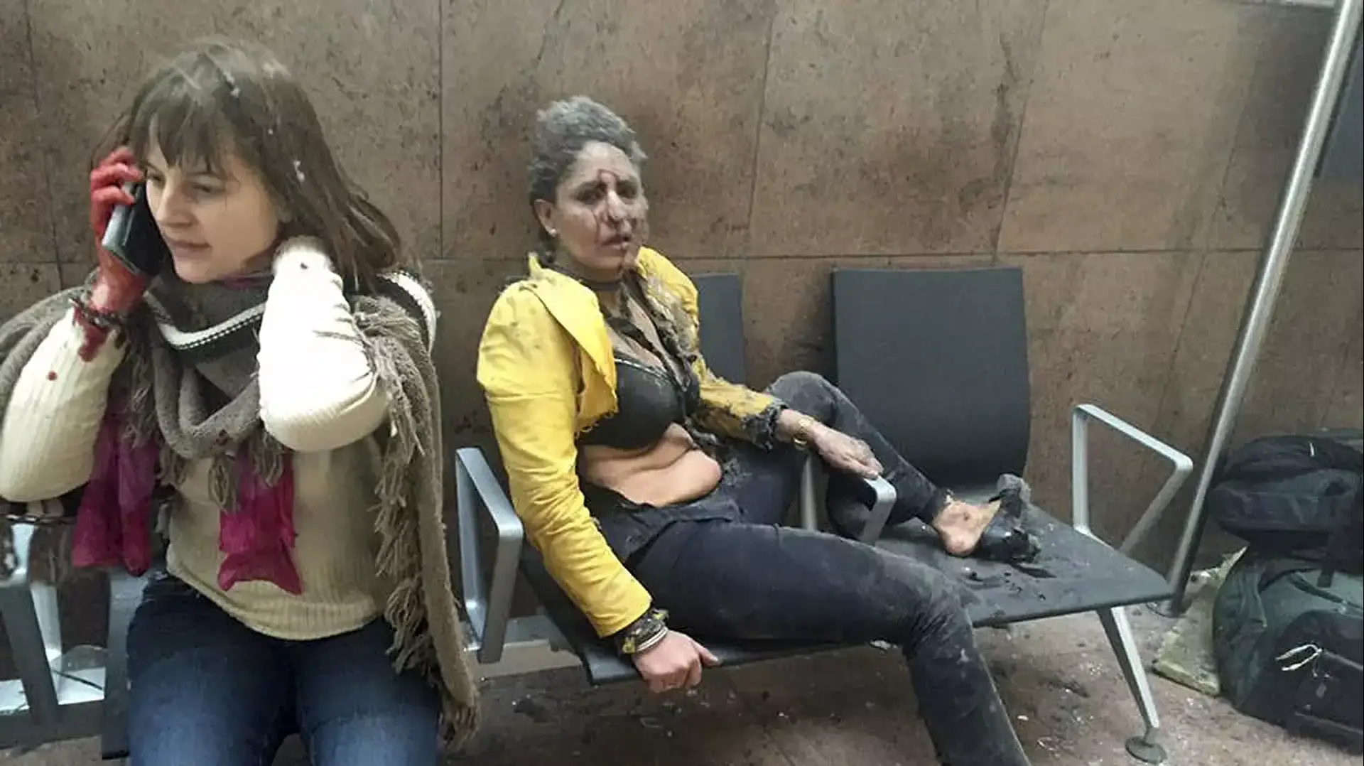 פצועות לאחר הפיצוץ בשדה התעופה בבריסל פצועות לאחר הפיצוץ בשדה התעופה בבריסל