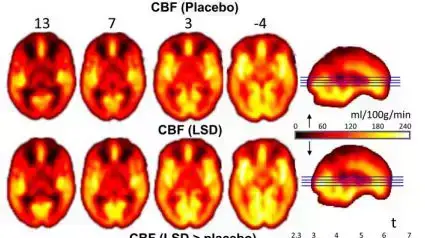 השפעת LSD על המוח השפעת LSD על המוח