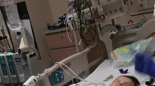 זימאה וסקרלט הרננדז טורס, תאומות סיאמיות בנות 11 חודשים מטקסס שבארצות הברית, שעברו ניתוח מסובך להפרדתן, אפריל 2016 זימאה וסקרלט הרננדז טורס, תאומות סיאמיות בנות 11 חודשים מטקסס שבארצות הברית, שעברו ניתוח מסובך להפרדתן, אפריל 2016