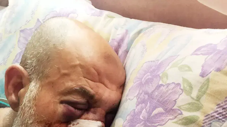 זוהיר אבו חדיר, קרוב משפחה של מוחמד אבו חדיר, שהותקף בירושלים, אפריל 2016
