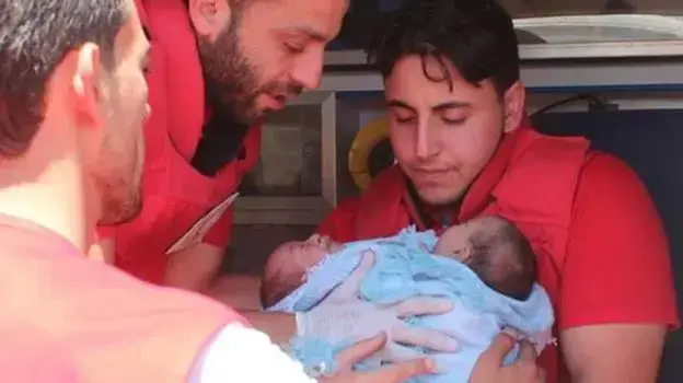 תאומים סיאמיים נולדו באזור מוכה קרבות בסוריה תאומים סיאמיים נולדו באזור מוכה קרבות בסוריה