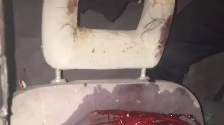 ניסיון פיגוע דריסה במחנה הפליטים שועפאט שבמזרח ירושלים. 5 בספטמבר 2016 ניסיון פיגוע דריסה במחנה הפליטים שועפאט שבמזרח ירושלים. 5 בספטמבר 2016