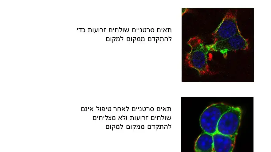 מחקר סרטן השד מחקר סרטן השד